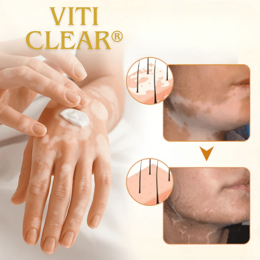 VitiClear - Tratamento Avançado!