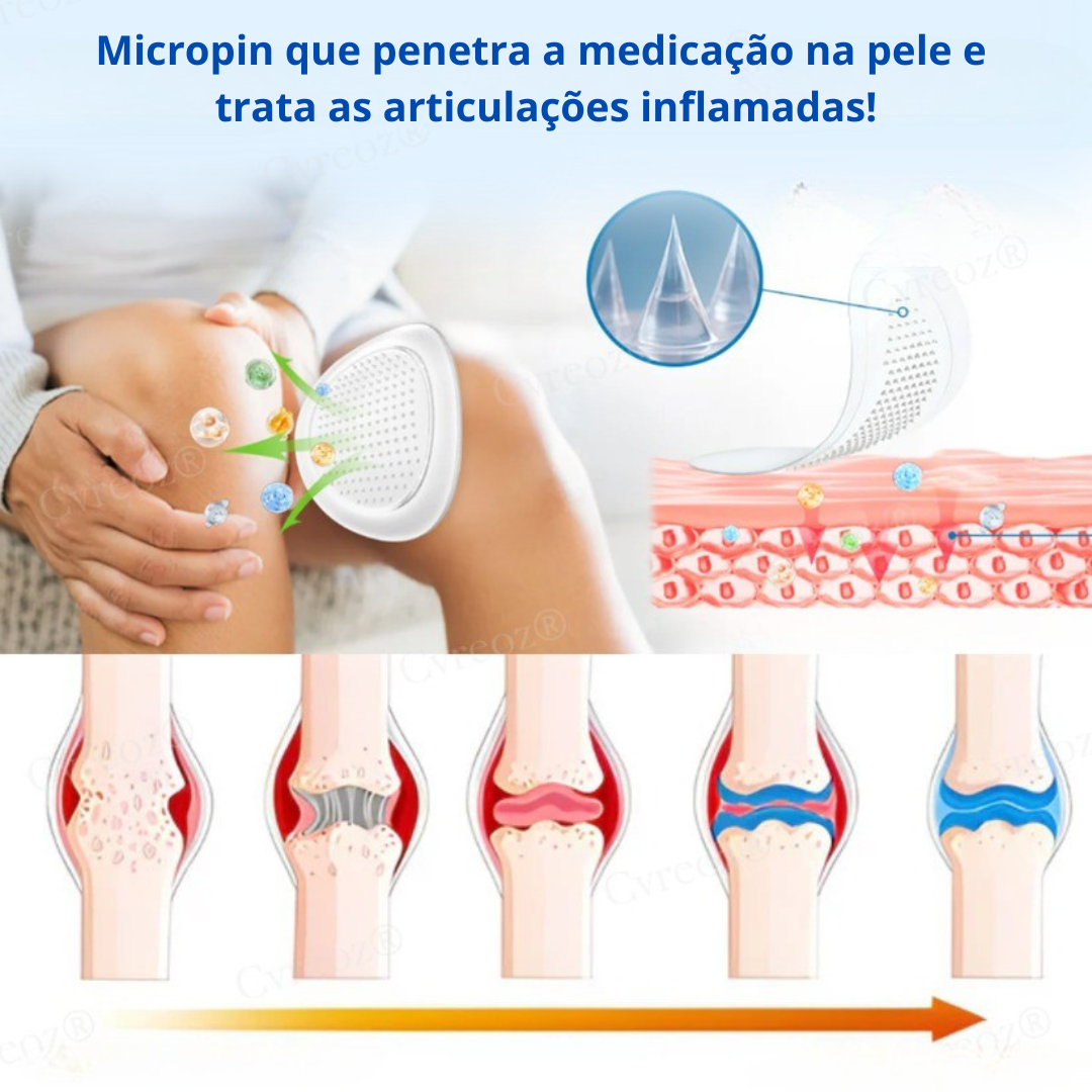 MIcropin - Adesivo Microagulhas para dores intensas