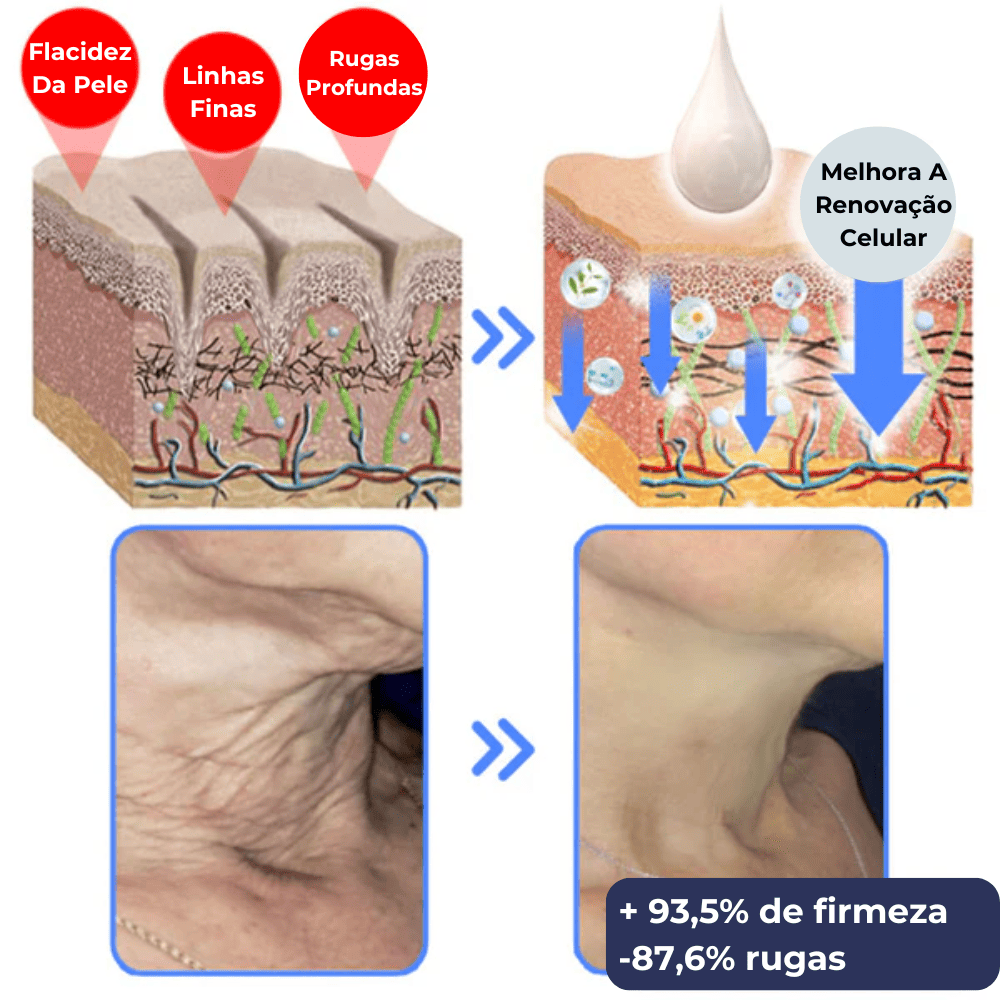 Creme Firmeza Natural Mixderme - Tratamento antienvelhecimento