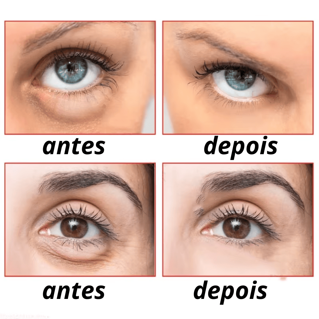 Luteina GLOW Rolon 5 em 1 ultra - Rejuvenescedor