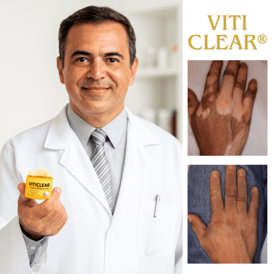 VitiClear - Tratamento Avançado!
